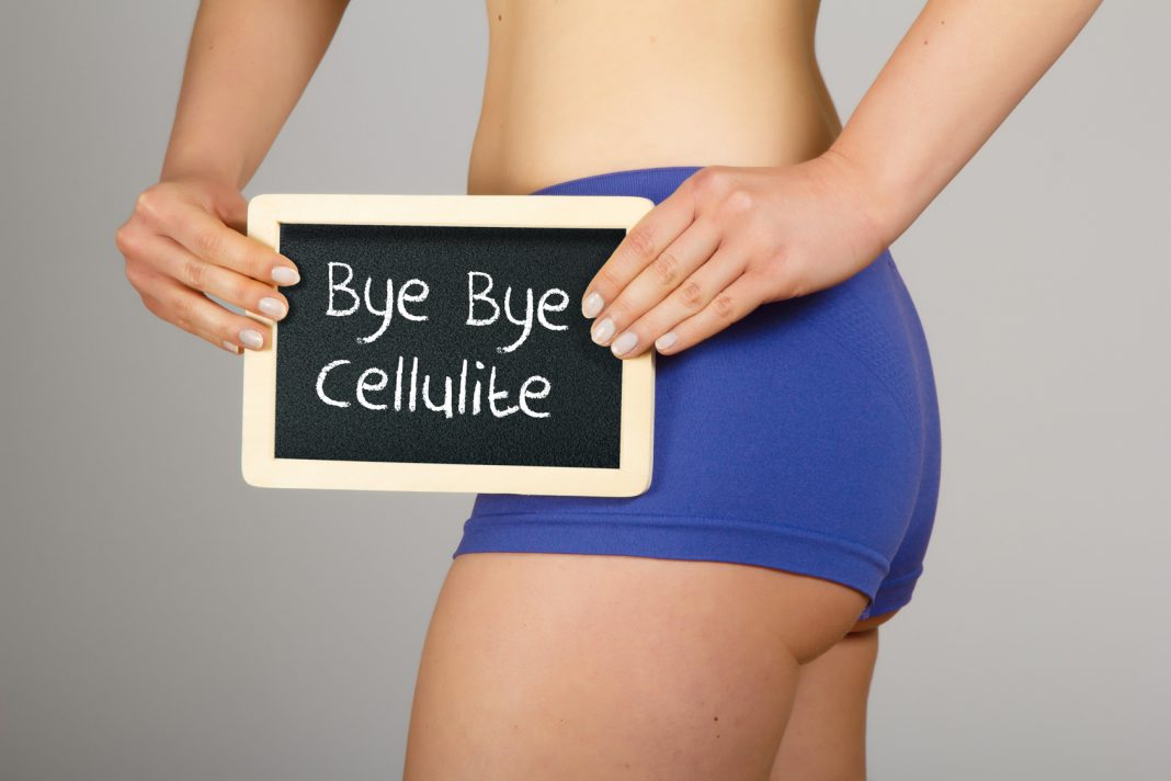 Was hilft bei Cellulite