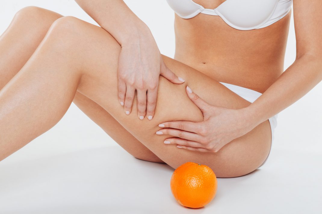 Hausmittel gegen Cellulite. Reduzieren Sie die Orangenhaut mit der richtigen Ernährung, Massagen und der Anti-Cellulite-Pflege. © djile - Fotolia.com